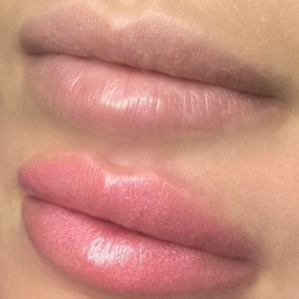 Permanent Make-up Lippen vorher nachher 2